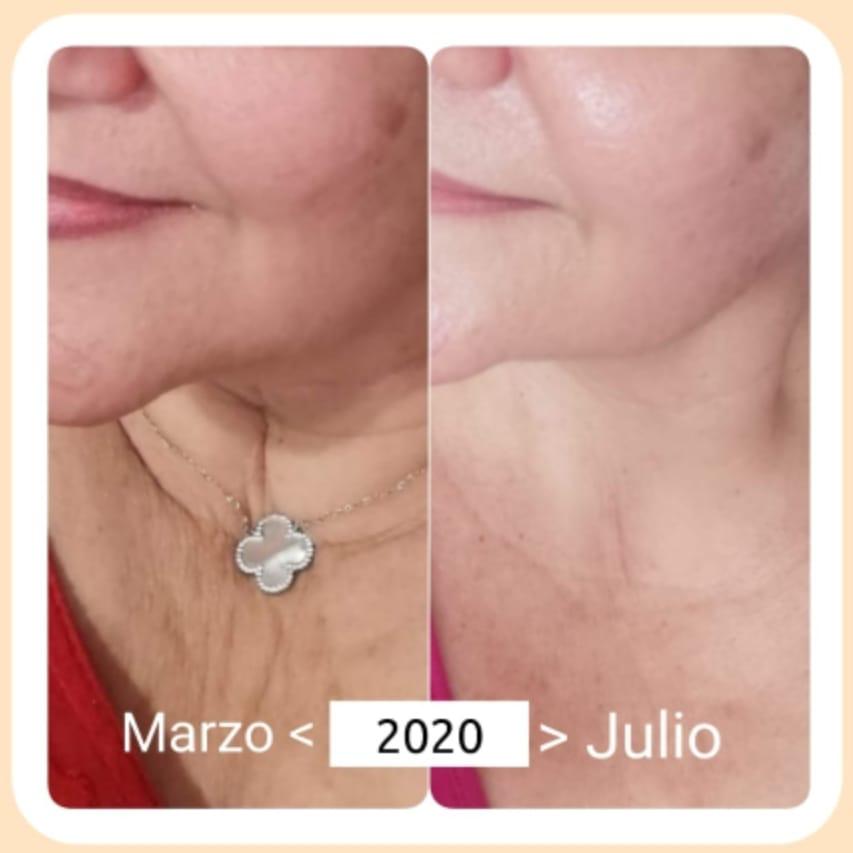 DABO Collagen Lifting Skin Care Set