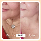 DABO Collagen Lifting Skin Care Set